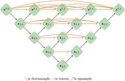 Multiple U-Net-Based Automatic Segmentations and Radiomics Feature Stability on Ultrasound Images for Patients With Ovarian Cancer